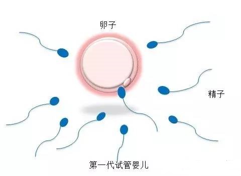 代孕一站式服务